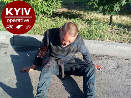 Словил "белочку": в сети проявили погромщика элитных авто на киевском Печерске(фото)