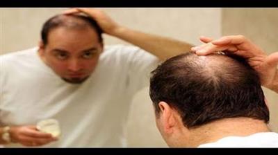 Natural Remedies To Treat Hair Loss. You Should Try