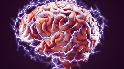 Neuroplasticity Everything you need to know!